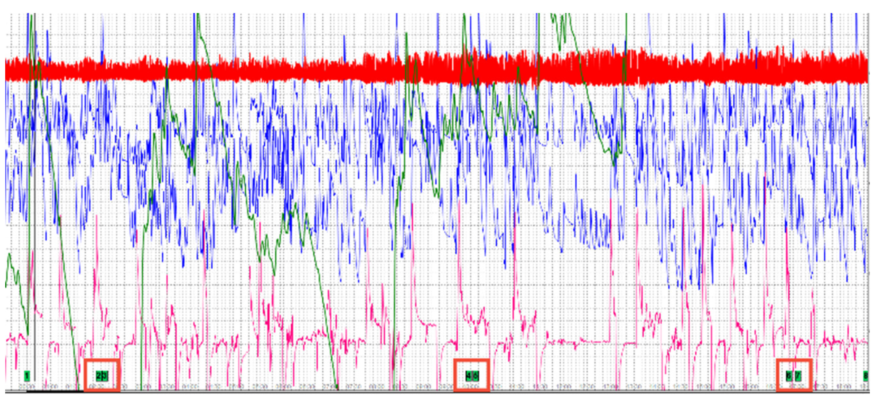 Preprints 109031 g008