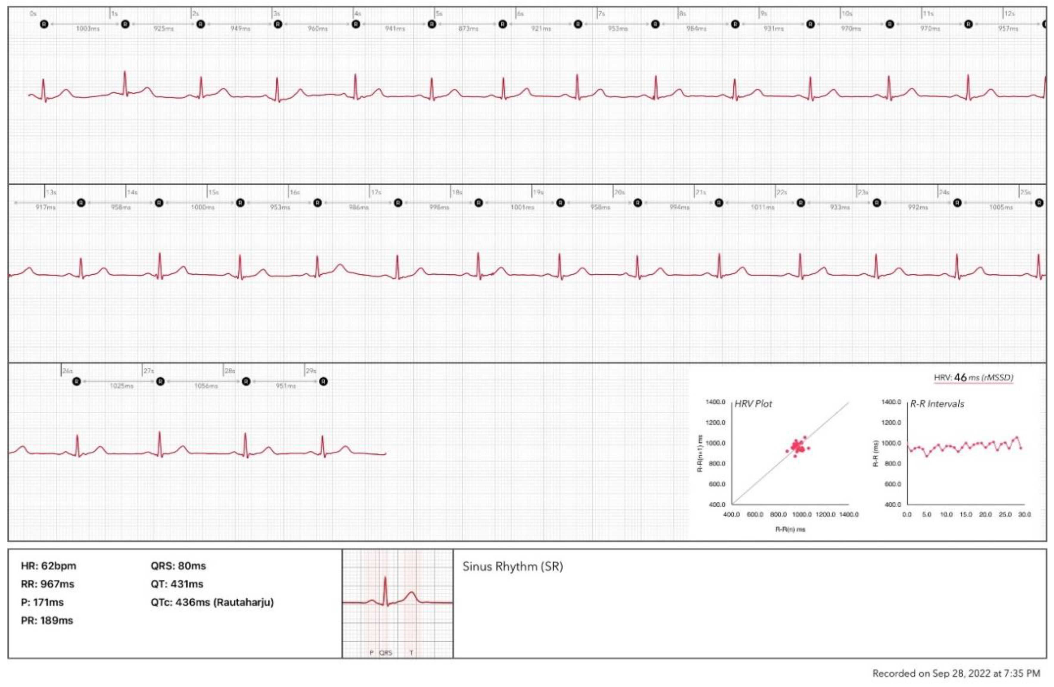 Preprints 81943 g003