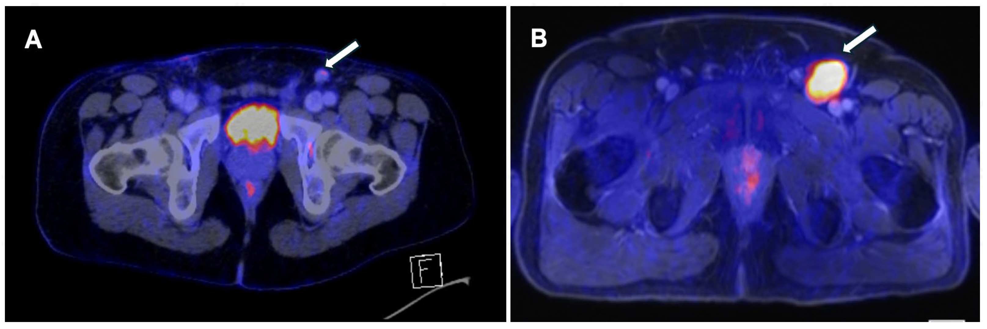 Preprints 111115 g001