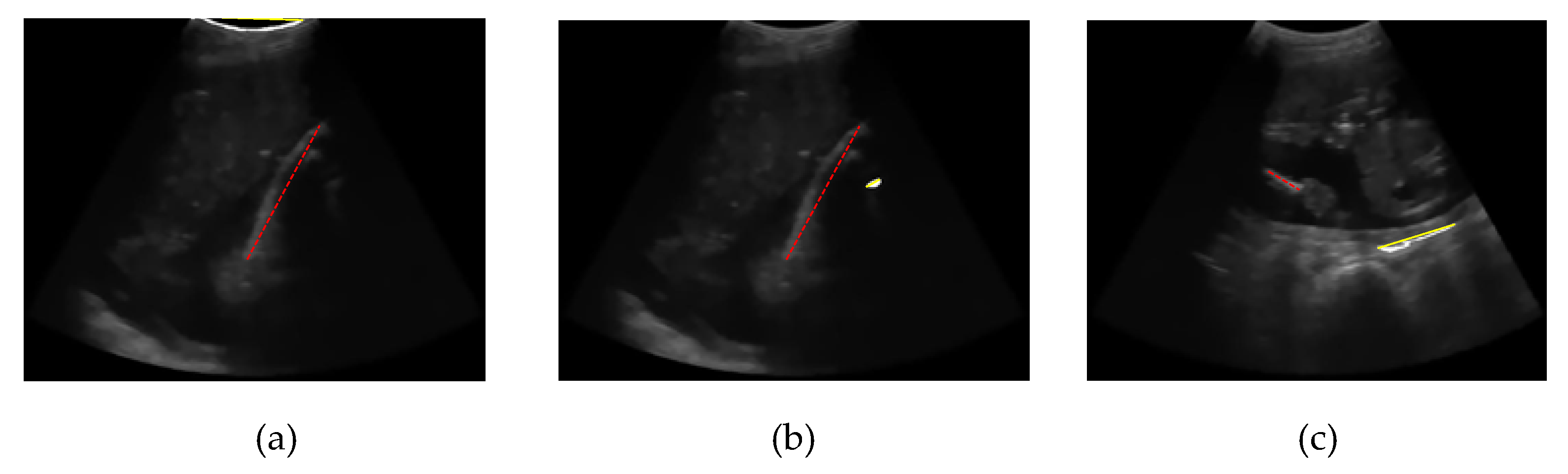 Preprints 93254 g022b