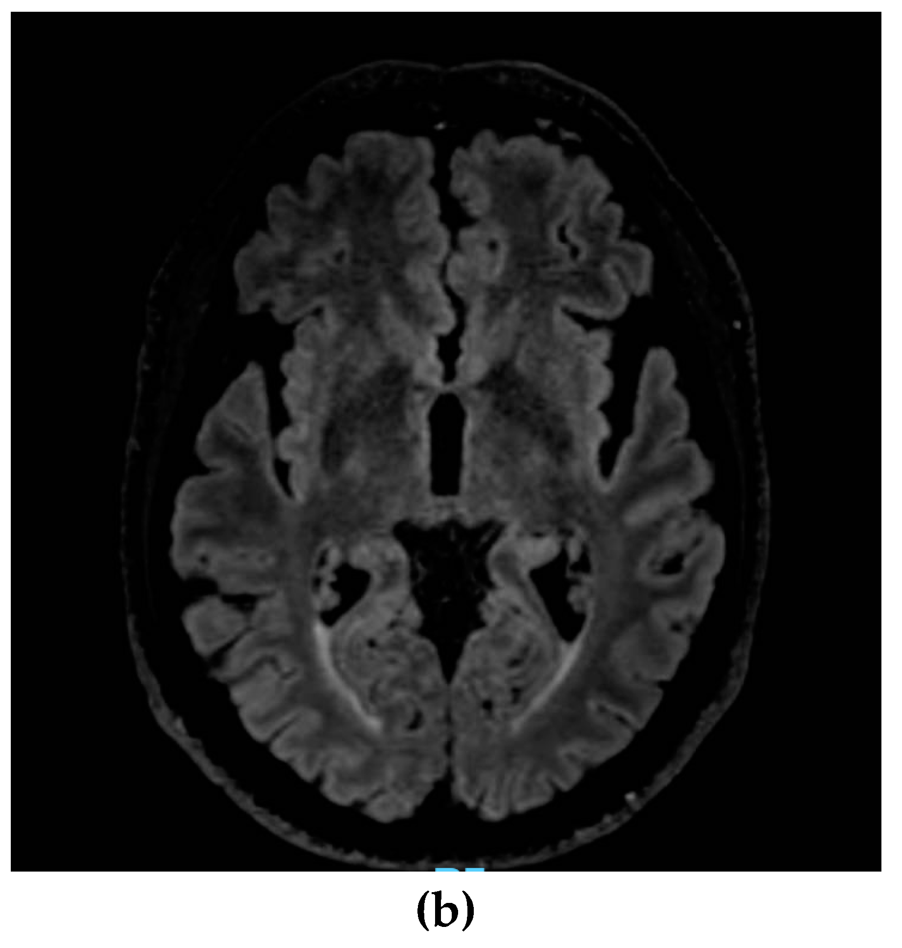 Preprints 80424 g001b