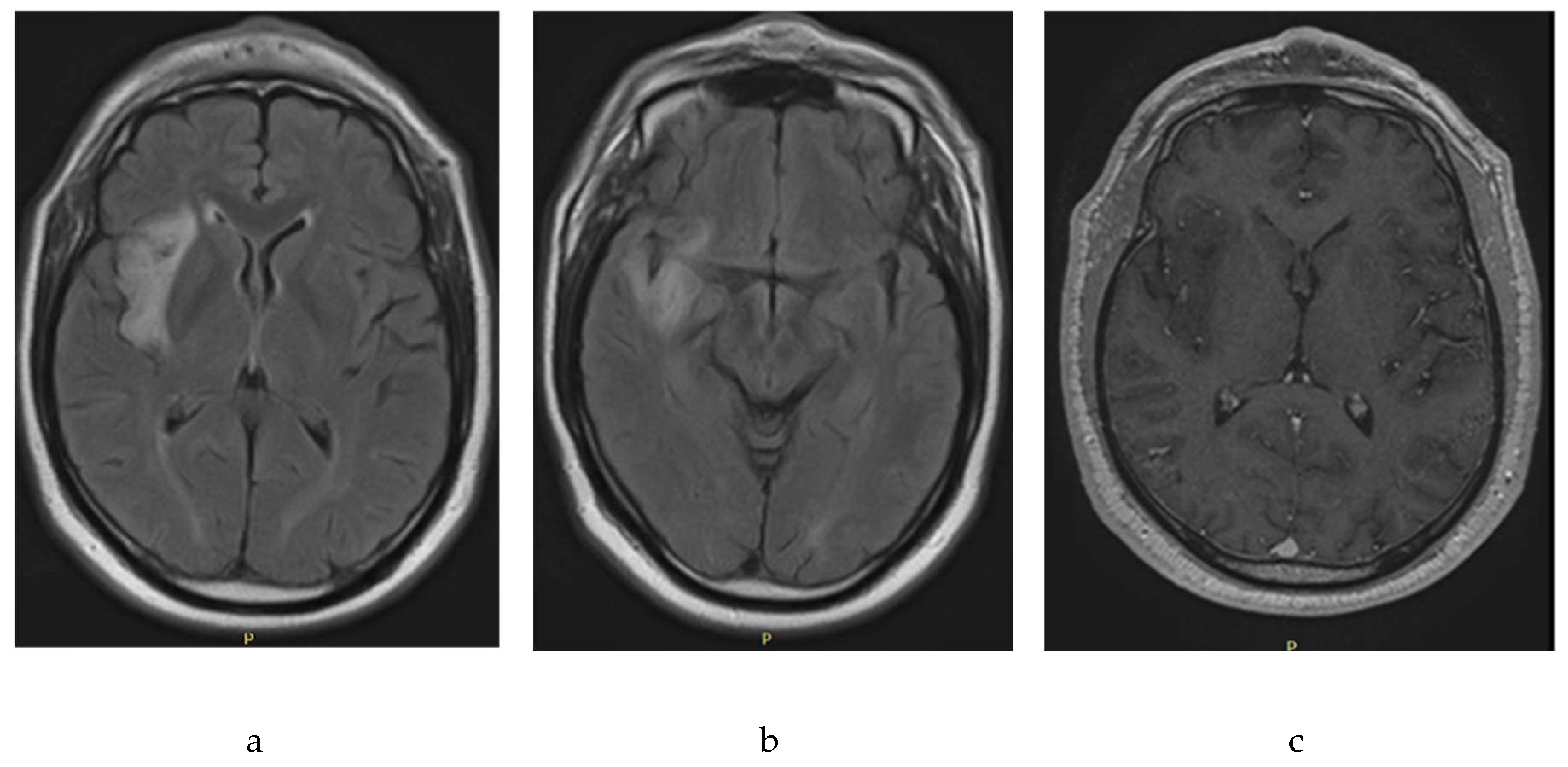 Preprints 94837 g001