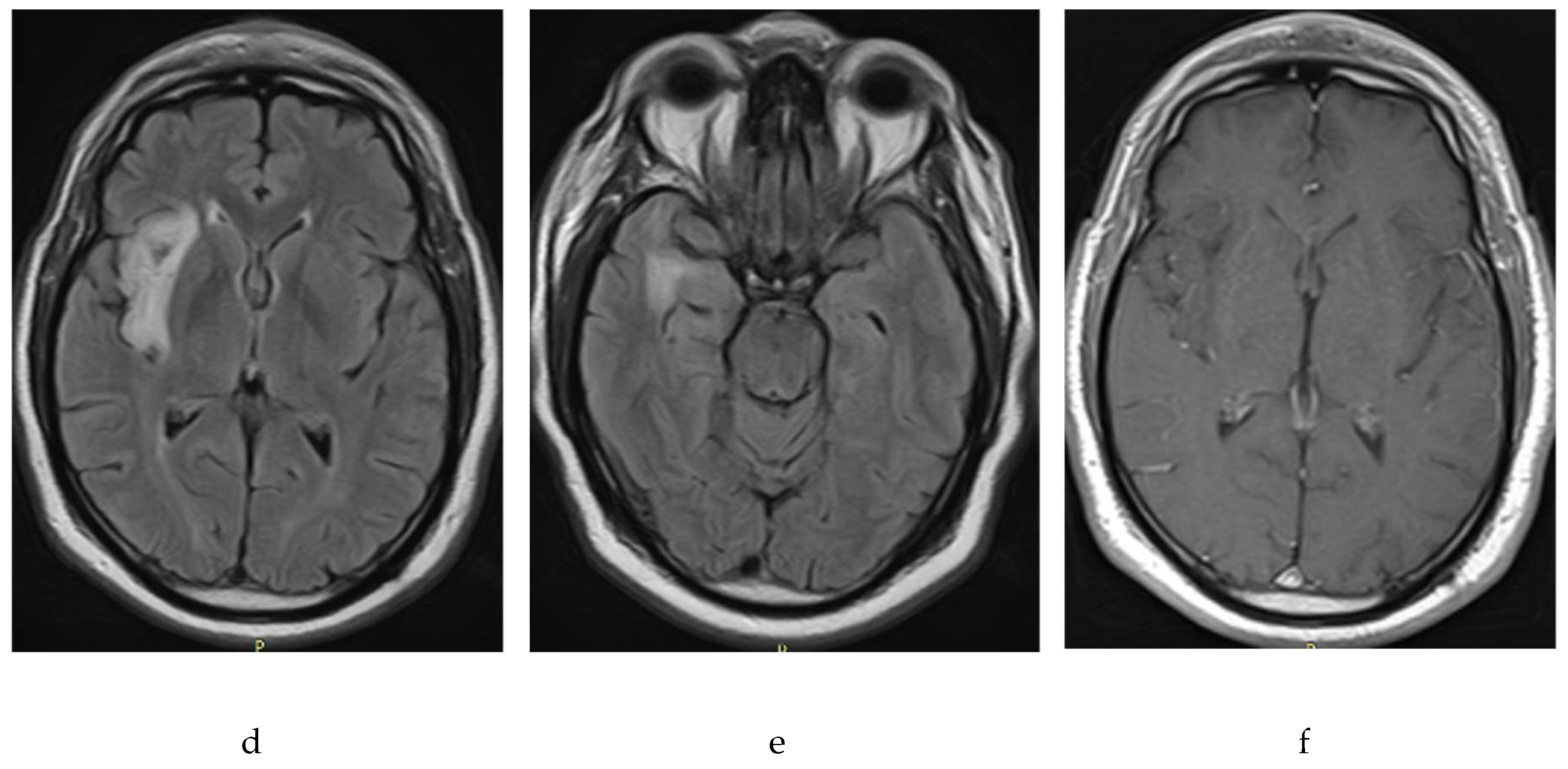 Preprints 94837 g002