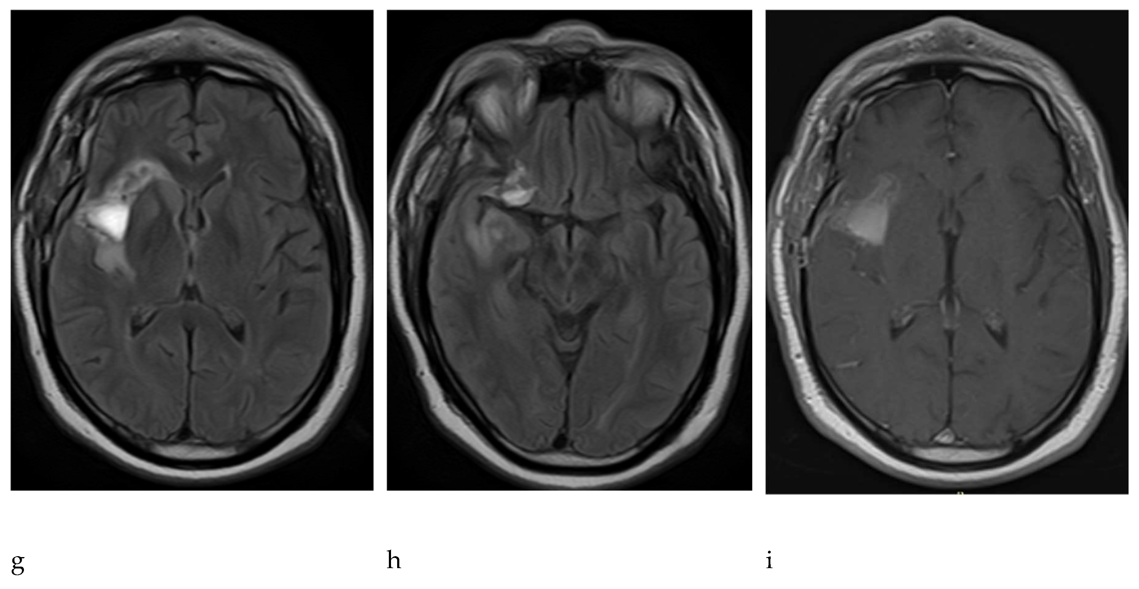 Preprints 94837 g003