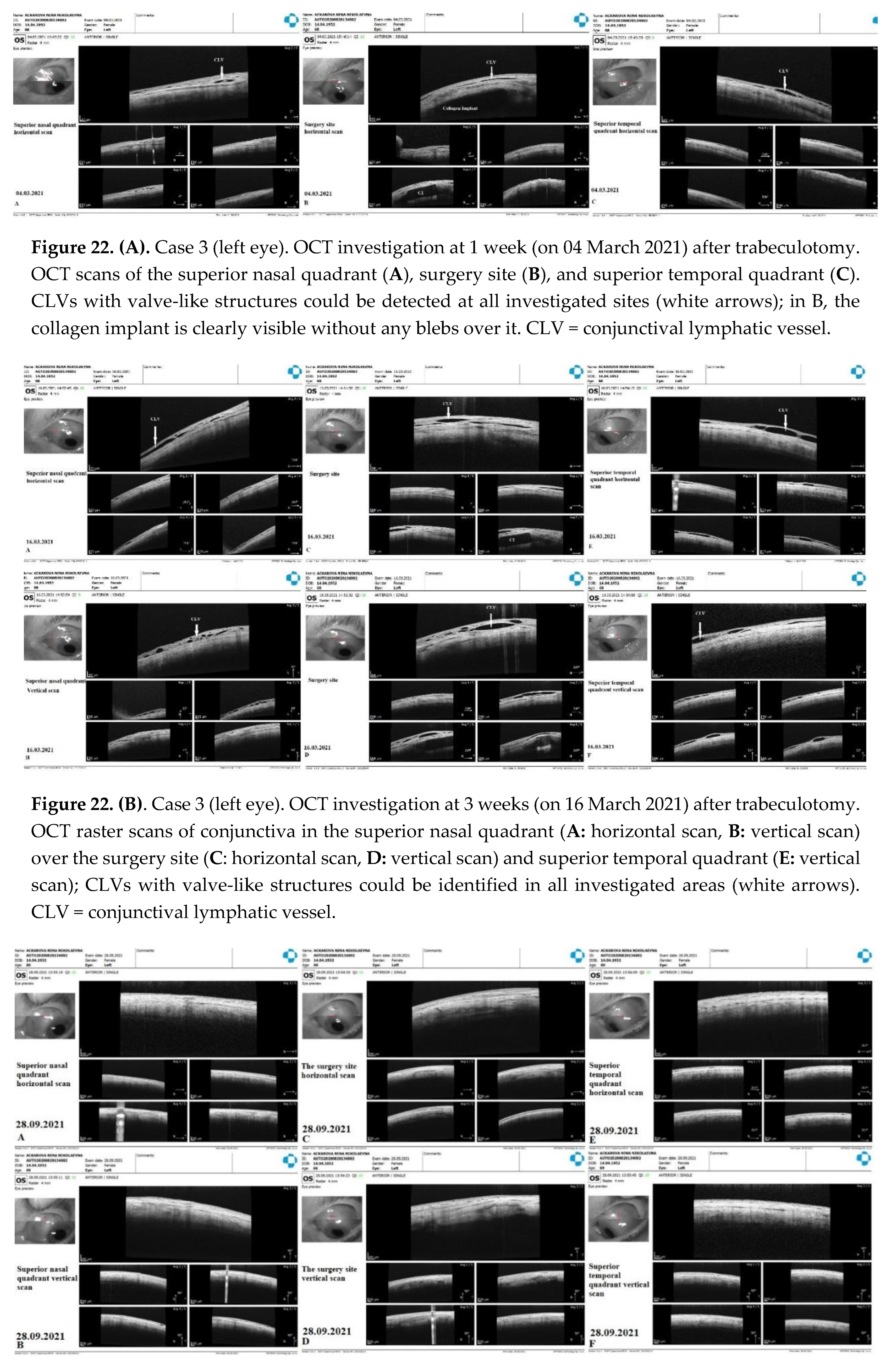 Preprints 81609 g022a