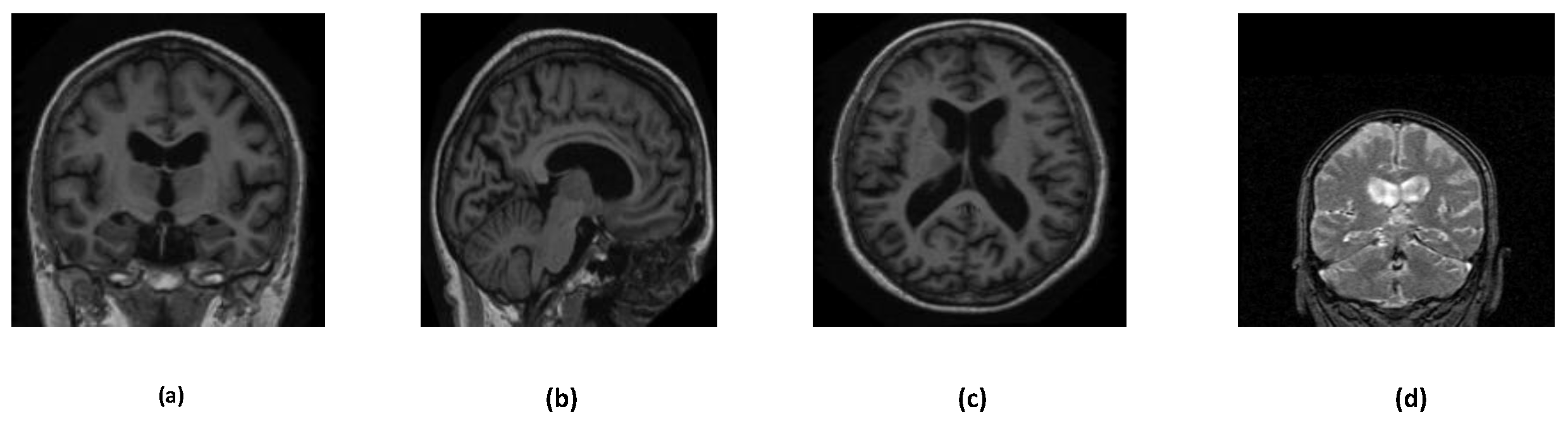 Preprints 72651 g002