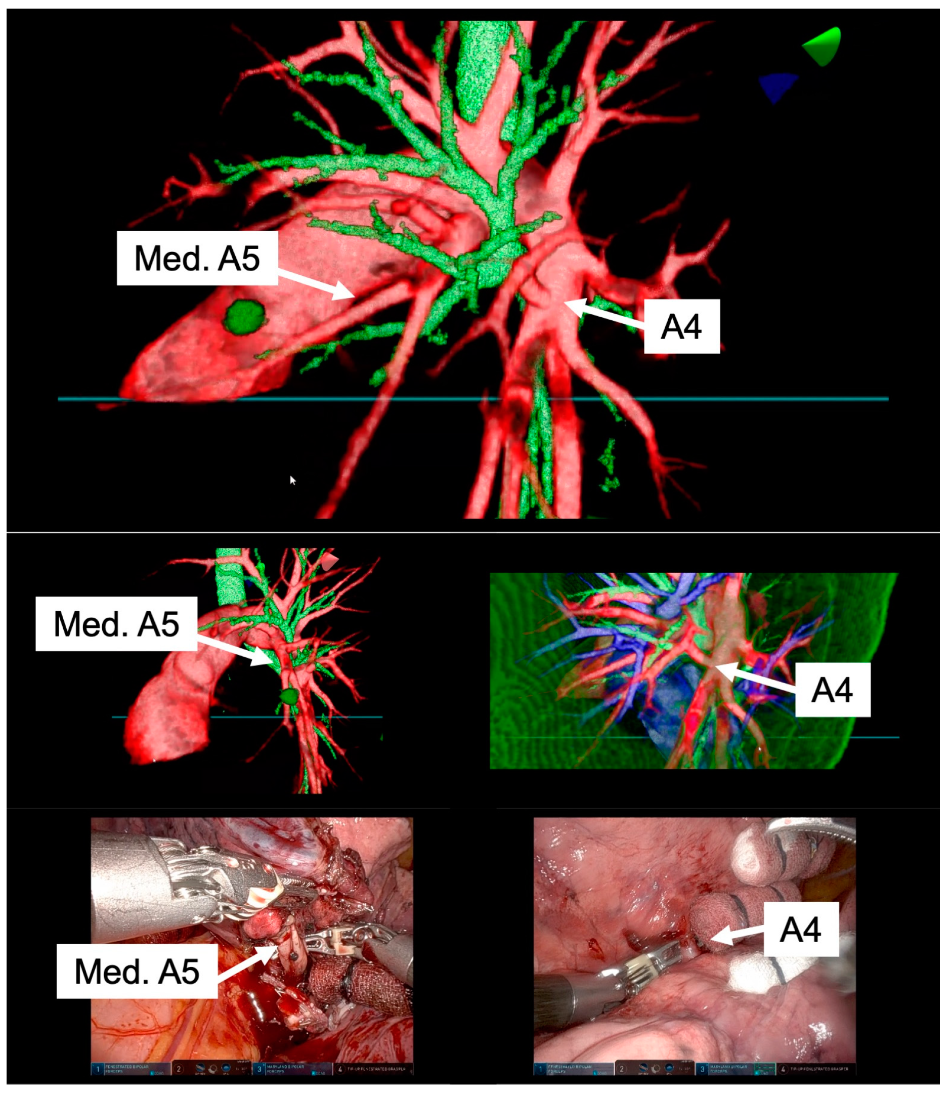 Preprints 95685 g004