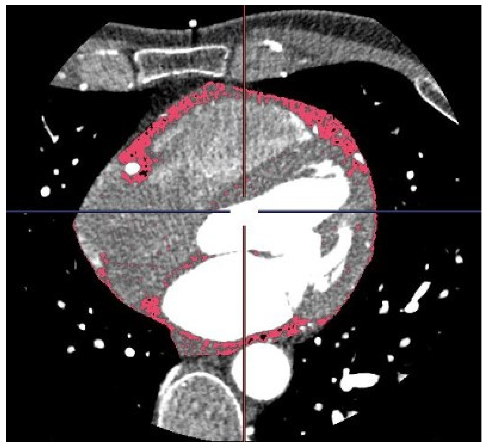 Preprints 84338 g001