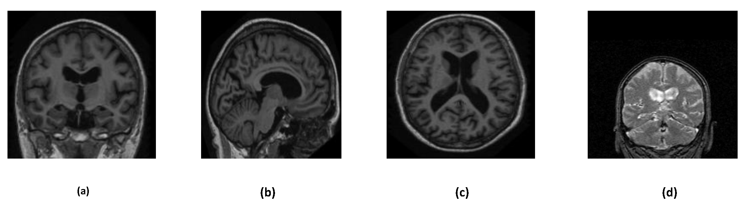 Preprints 72365 g002