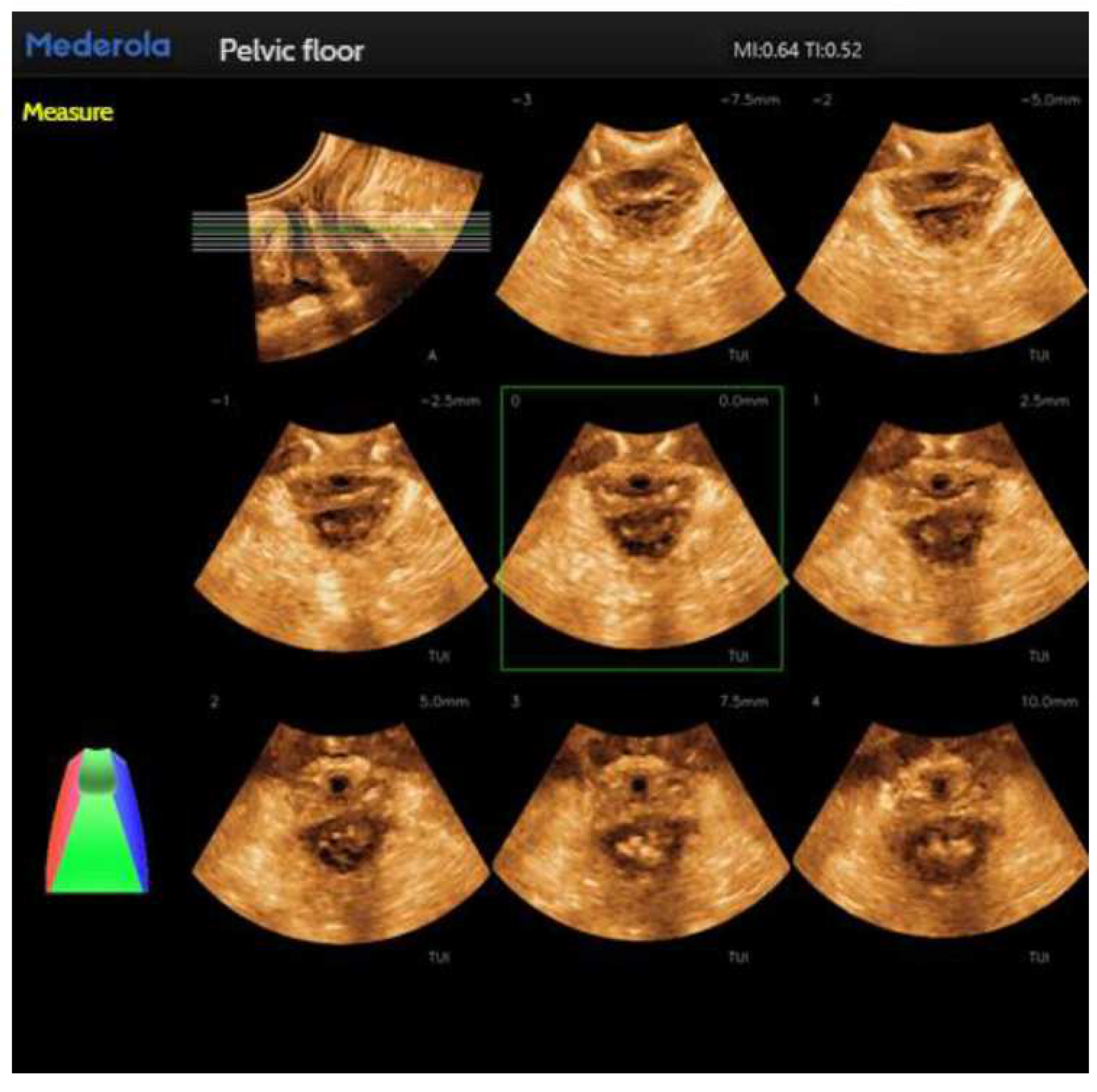 Preprints 91255 g004