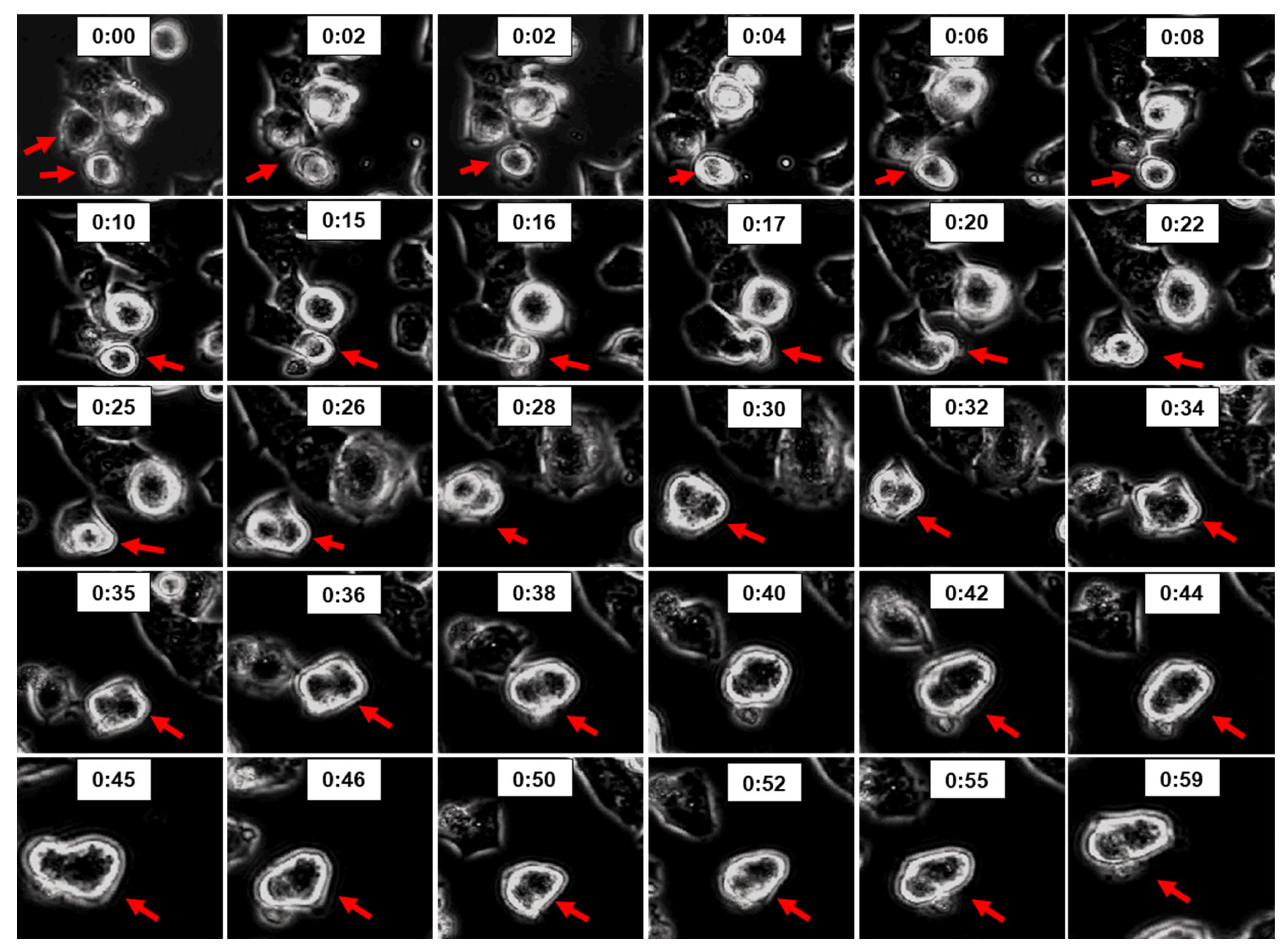 Preprints 104360 g011