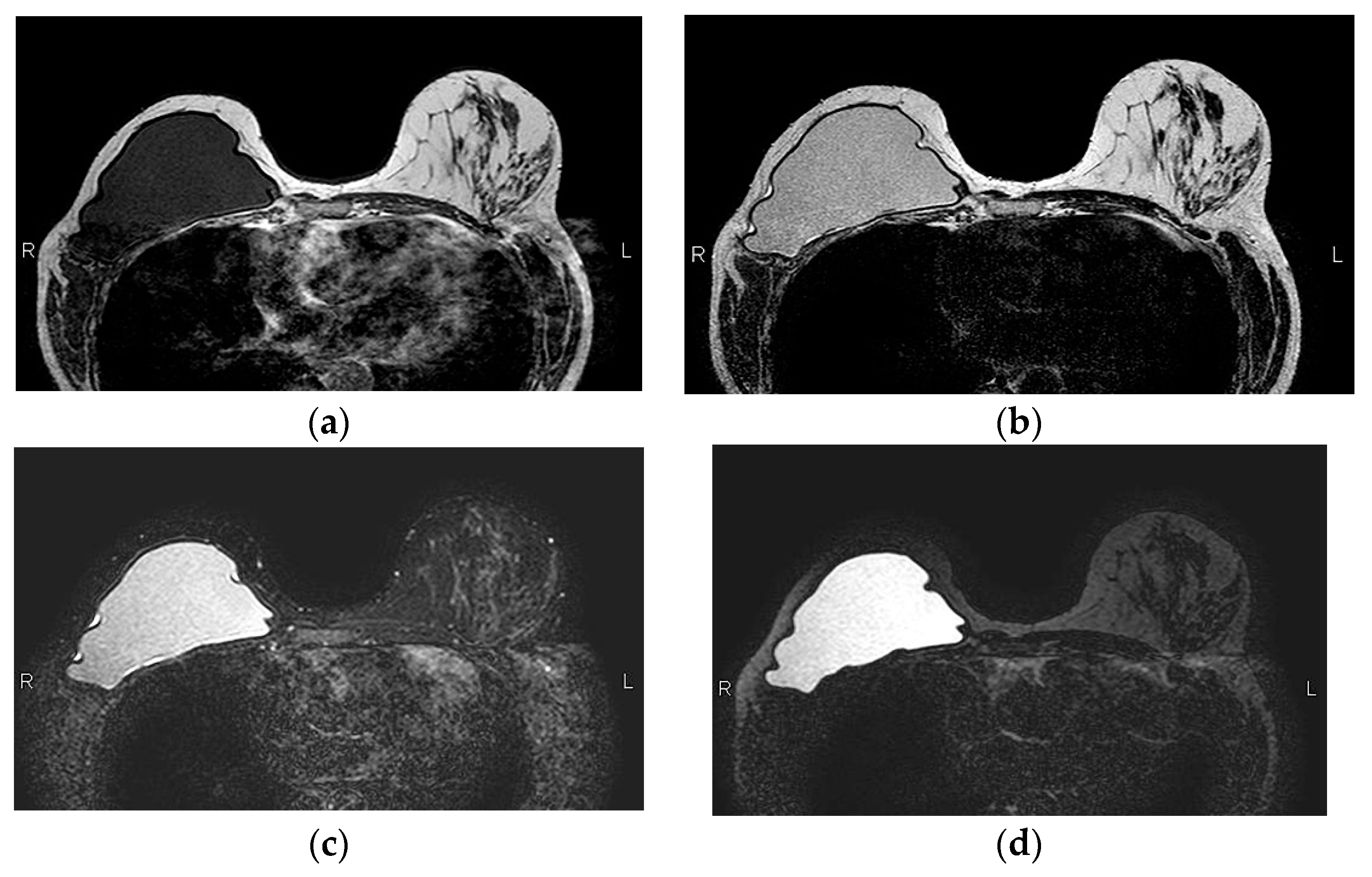 Preprints 82836 g004