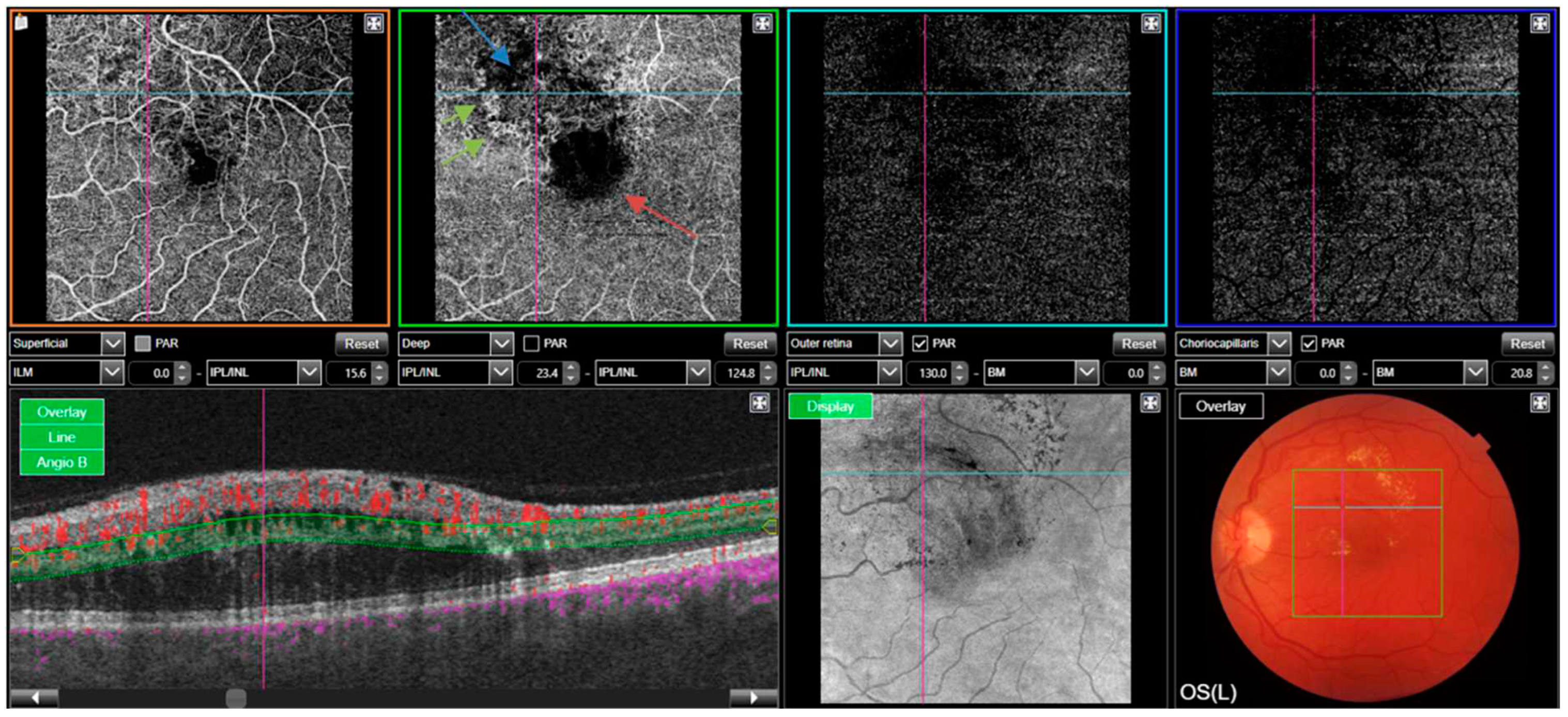 Preprints 68191 g003