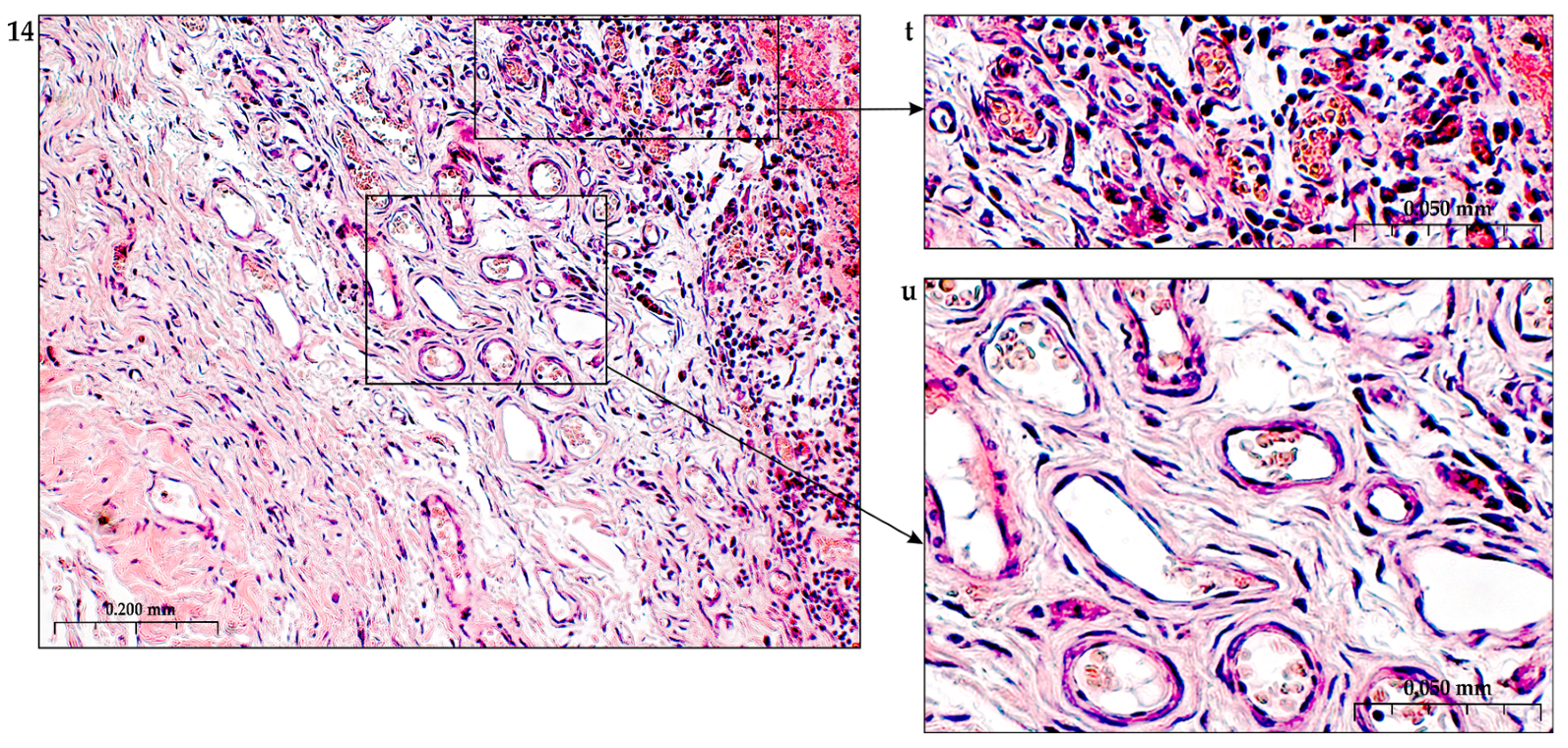 Preprints 116862 g017