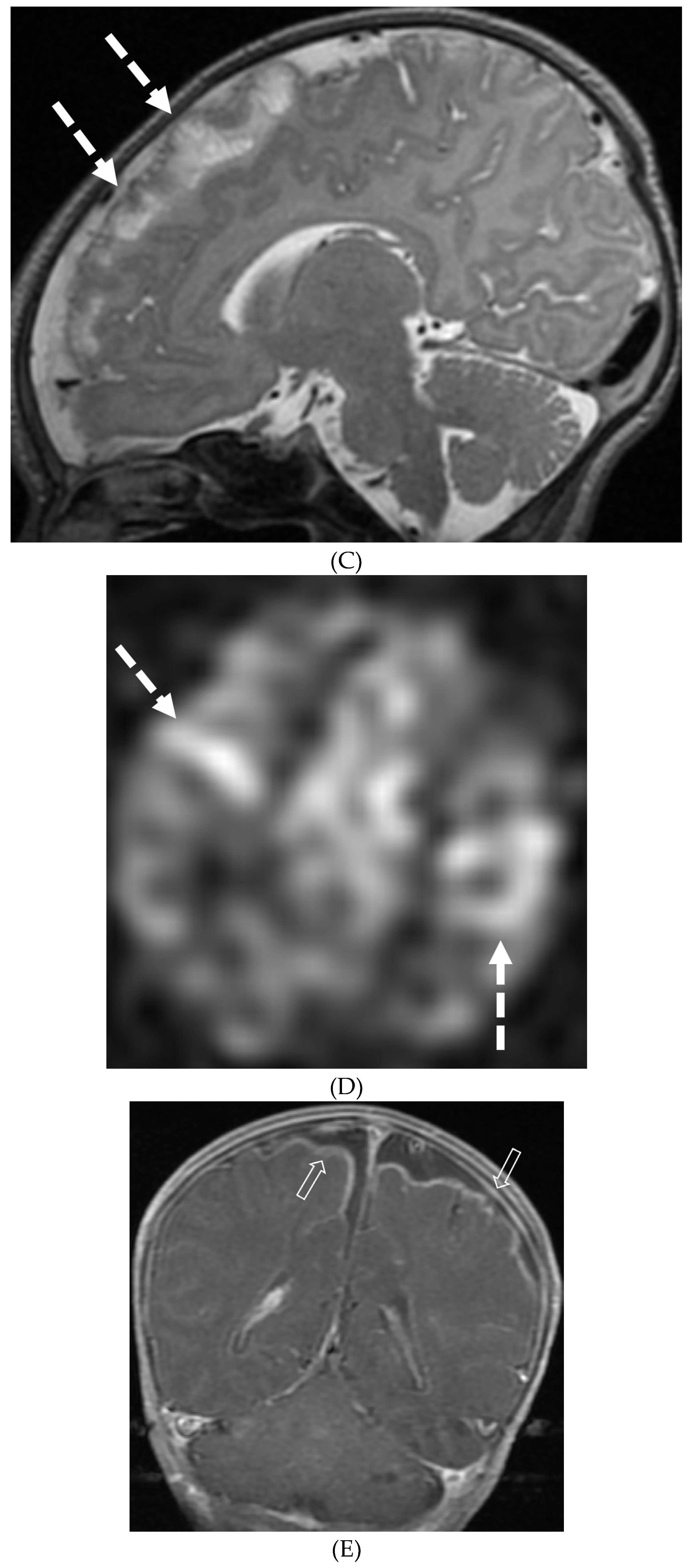 Preprints 118739 g012b