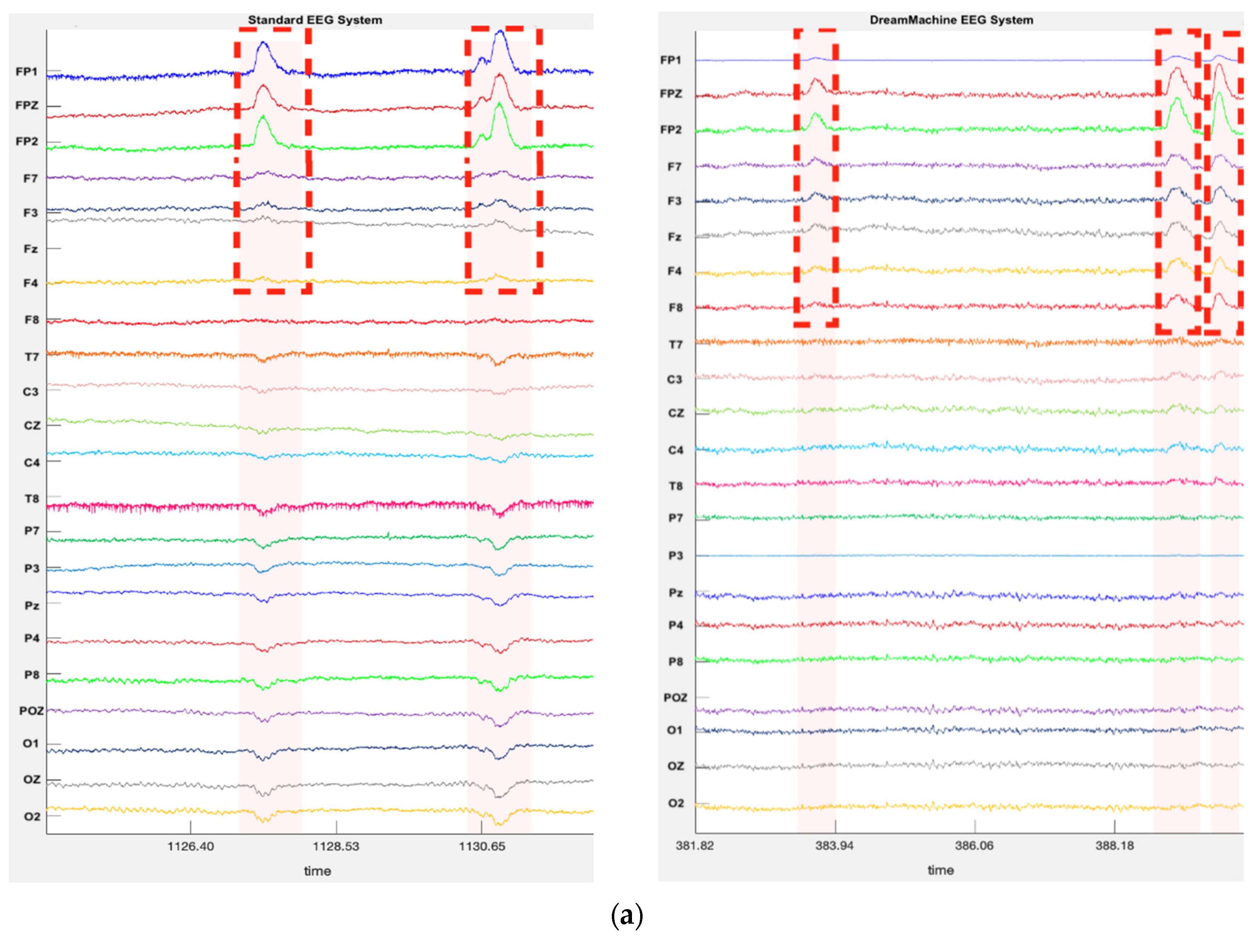 Preprints 81626 g004a