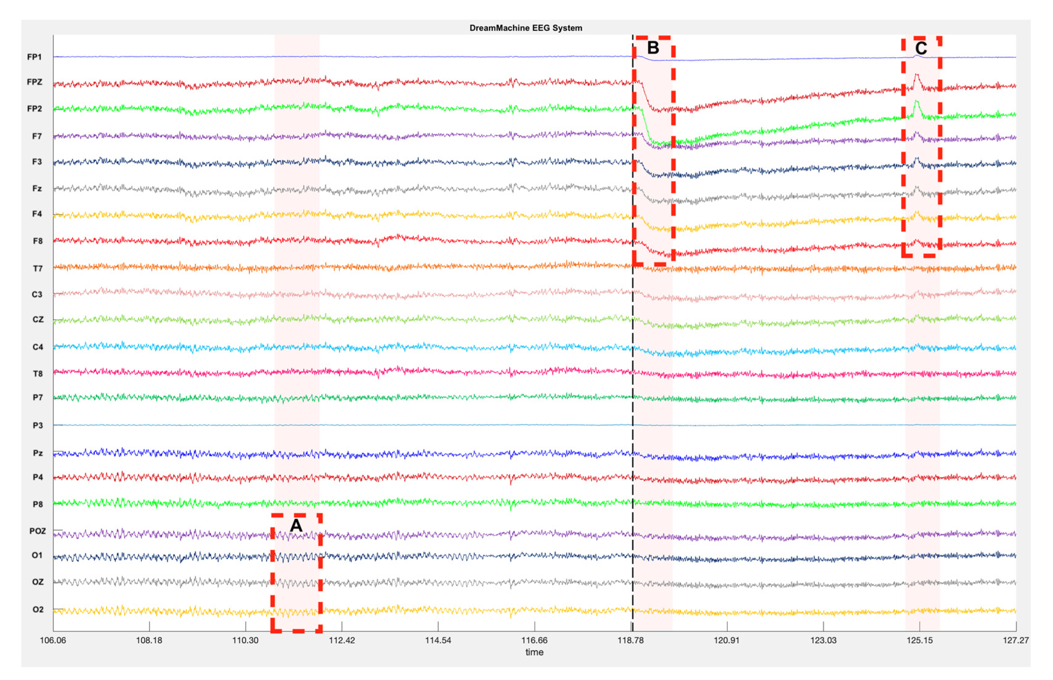 Preprints 81626 g005