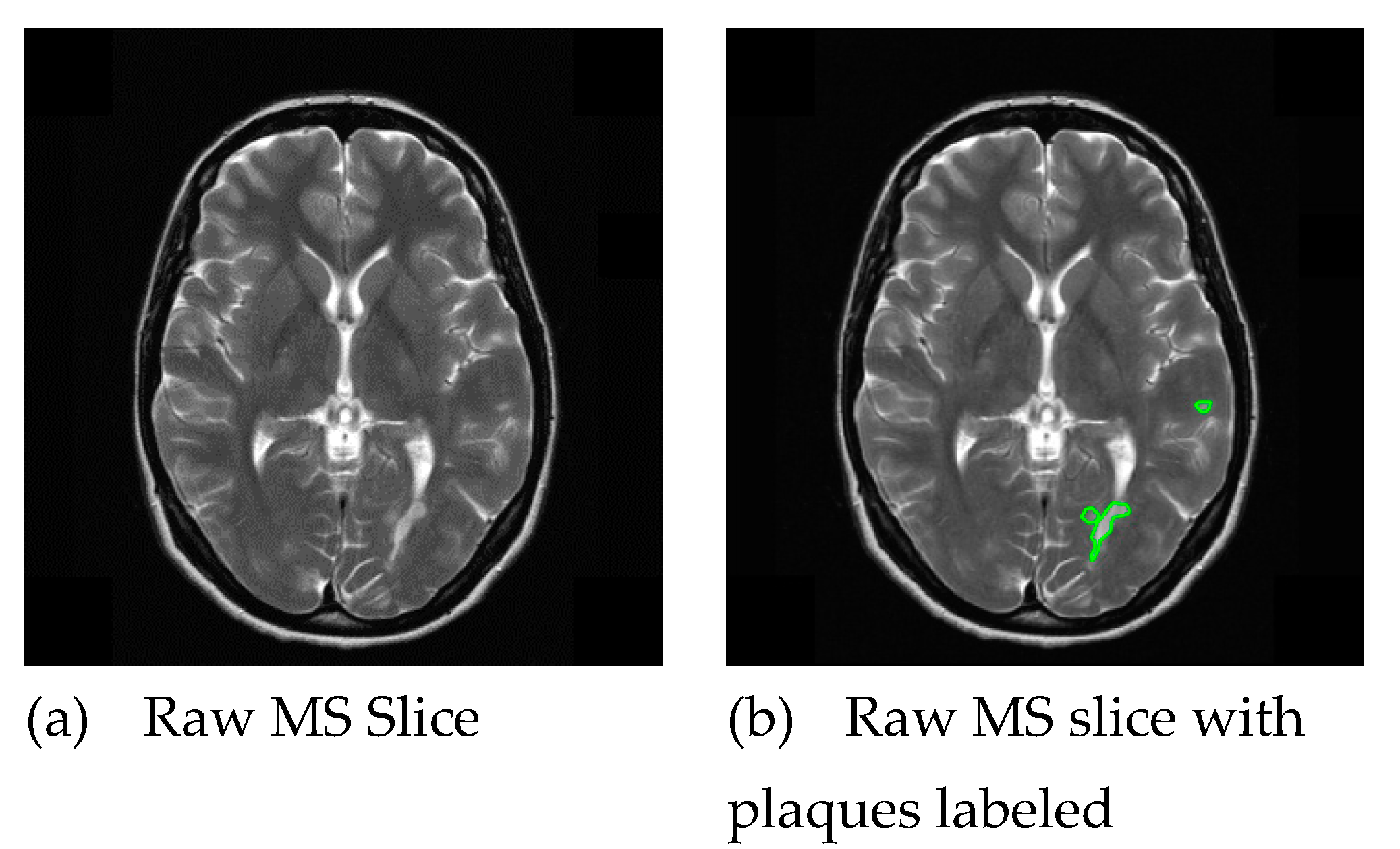 Preprints 87304 g001