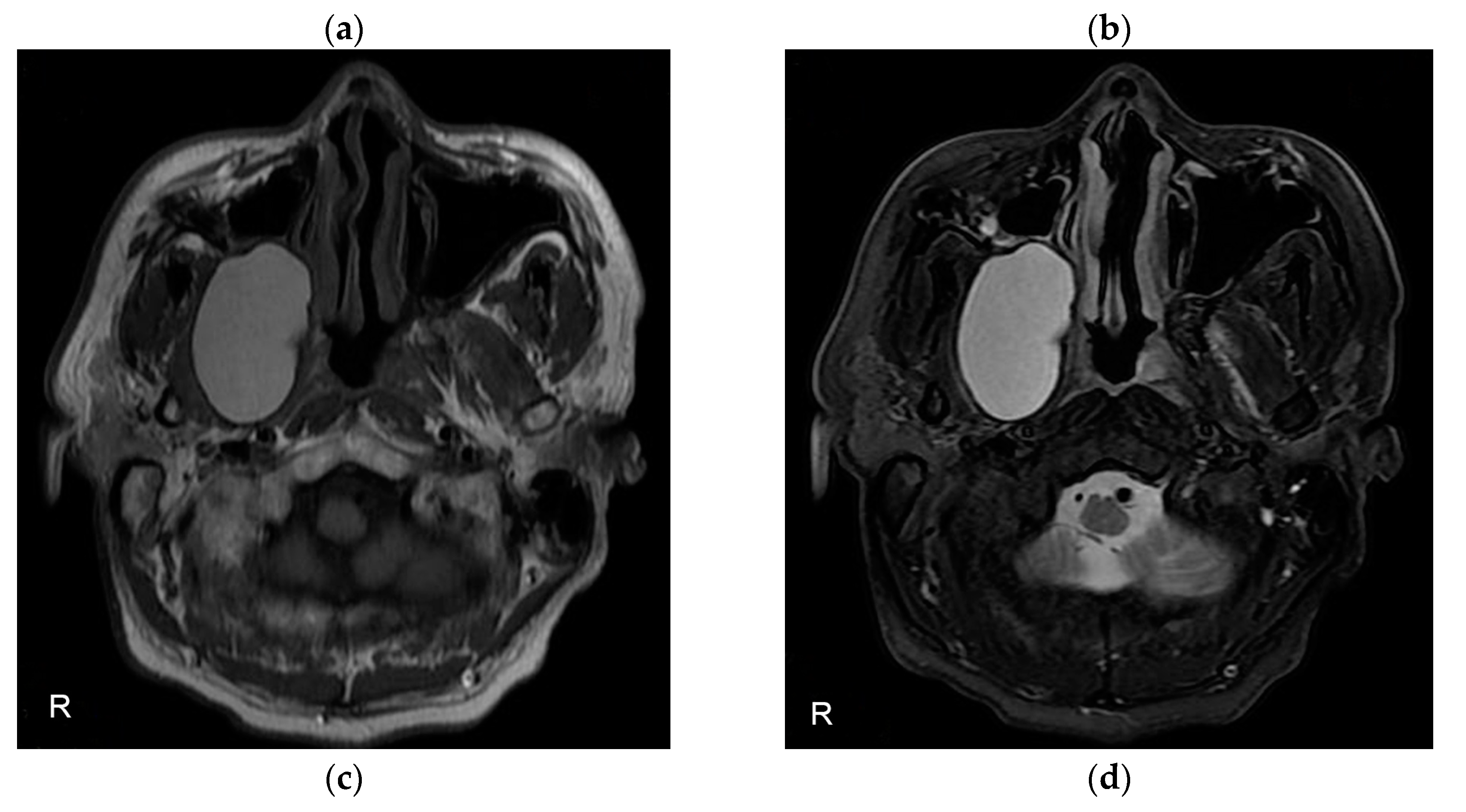 Preprints 72102 g002b