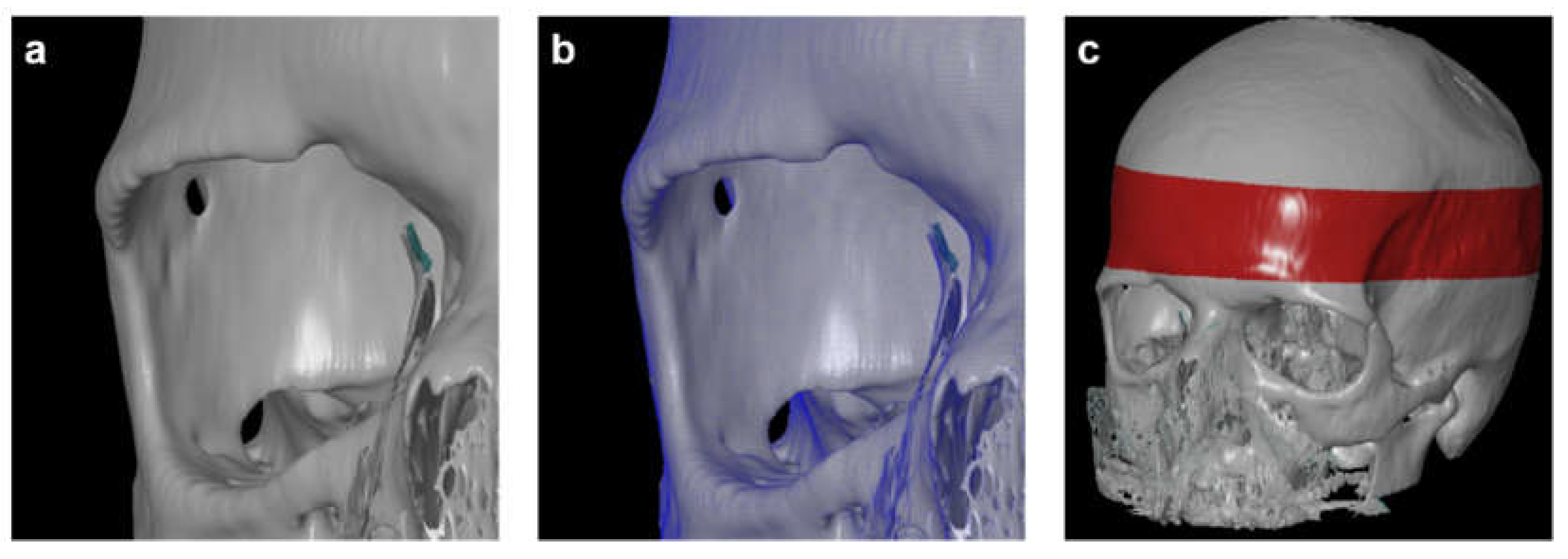 Preprints 71555 g003