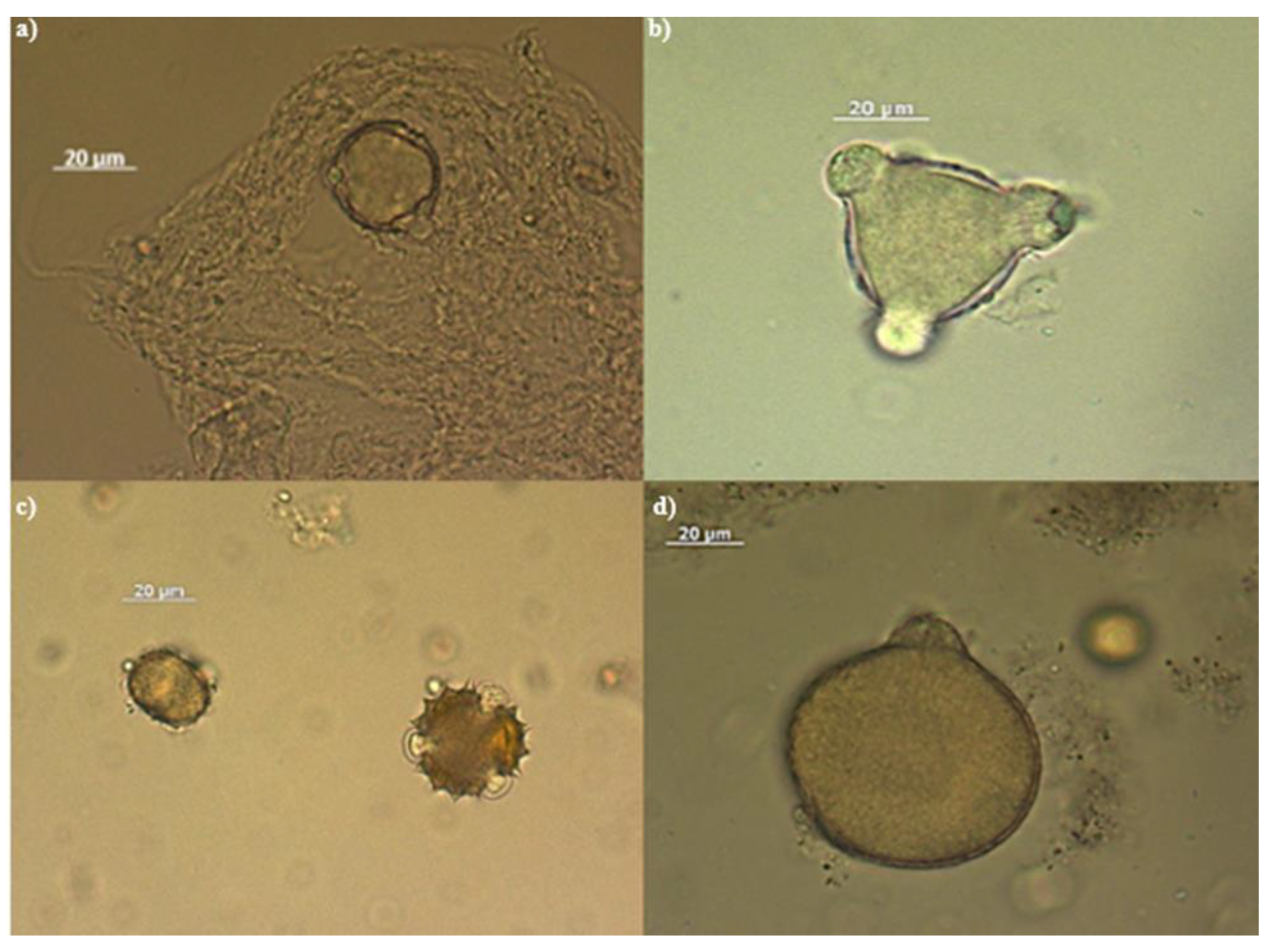 Preprints 118175 g001