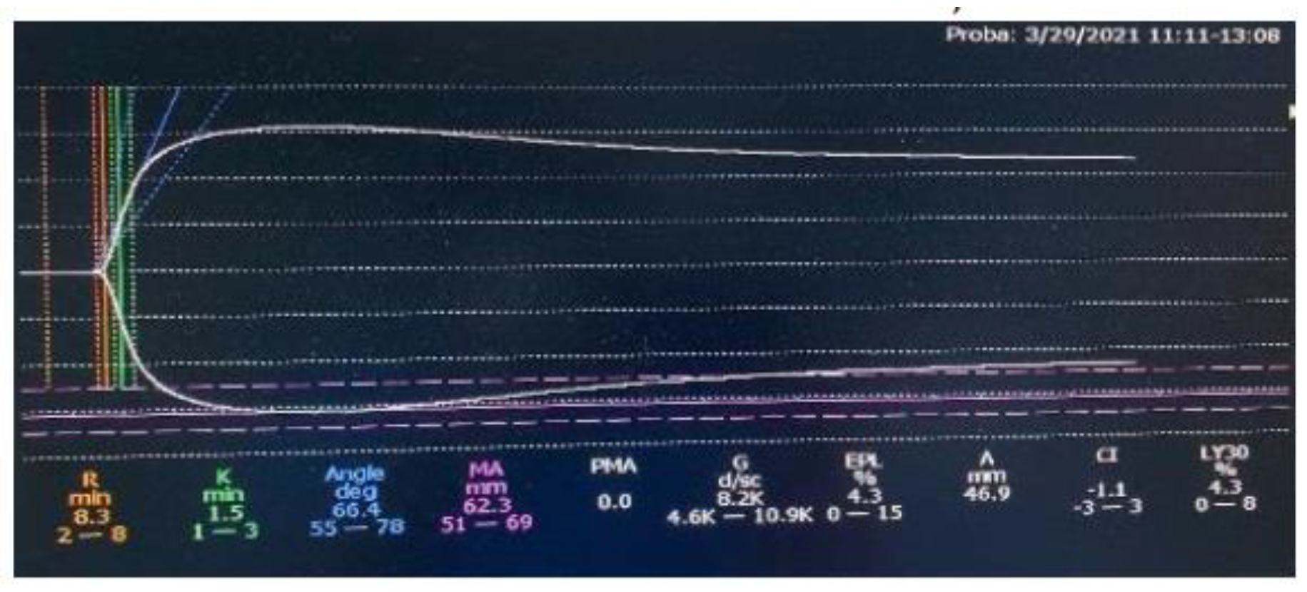 Preprints 85652 g002