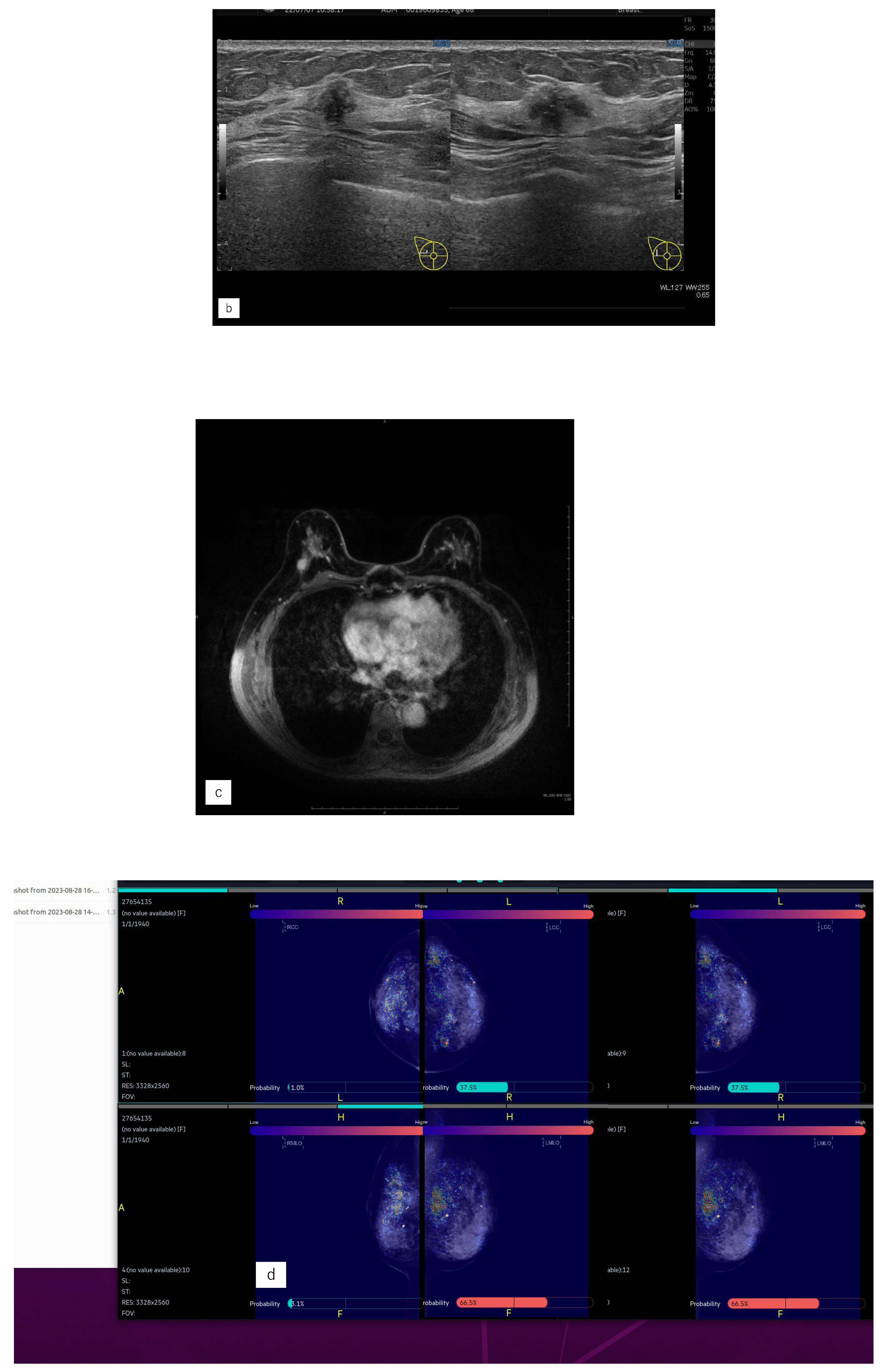 Preprints 113734 g005b