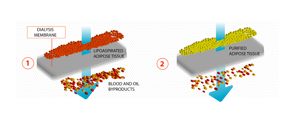 A Novel Method To Optimize Autologous Adipose Tissue Recovery With Extracellular Matrix Preservation V1 Preprints